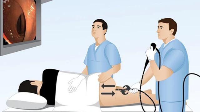 bai-viet/ky-thuat-noi-soi-tieu-hoa-tong-quan-chi-dinh-chong-chi-dinh-va-quy-trinh-thuc-hien.html