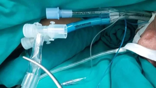 bai-viet/nhung-dieu-can-biet-ve-mo-khi-quan-va-cac-loai-ong-mo-khi-quan.html