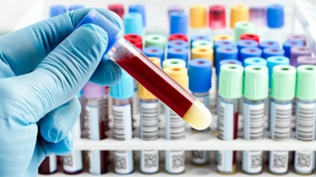 bai-viet/nhung-dieu-can-biet-ve-phuong-phap-sinh-thiet-long-ct-dna.html