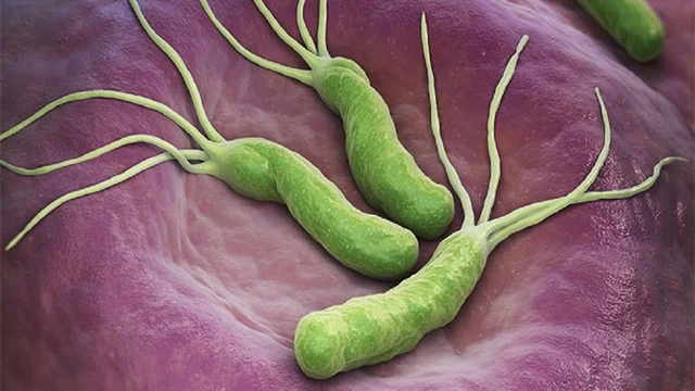 bai-viet/dieu-tri-hp-da-day-bao-lau-can-luu-y-dieu-gi-trong-qua-trinh-dieu-tri-70791.html