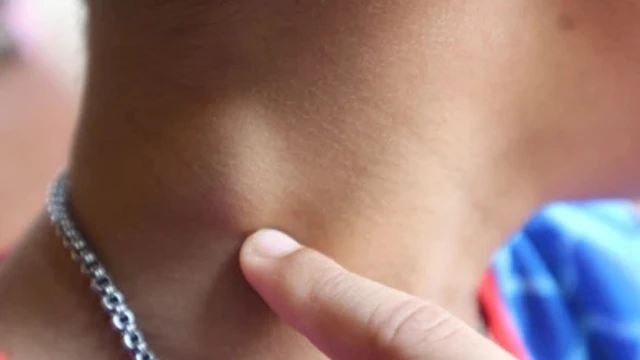 bai-viet/nhung-dieu-can-biet-ve-tinh-trang-tre-noi-hach-o-co-lau-ngay.html