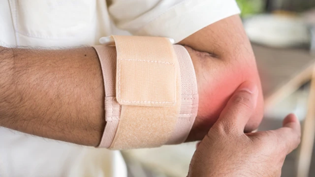 bai-viet/nhung-dieu-can-biet-ve-viem-diem-bam-gan-loi-cau-ngoai-xuong-canh-tay-56653.html