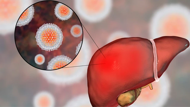 bai-viet/nhung-dieu-can-biet-ve-virus-viem-gan-b.html