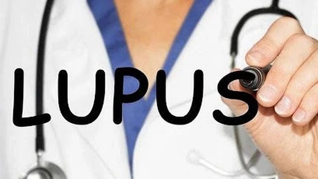 bai-viet/nhung-luu-y-ve-che-do-an-cho-nguoi-bi-lupus-ban-do-nhe-55711.html
