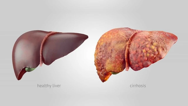 bai-viet/nhung-nguyen-nhan-nao-khien-chi-so-ggt-cao.html