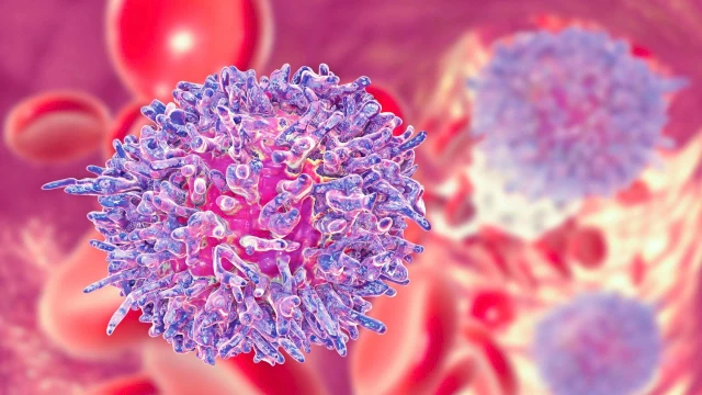 bai-viet/nhung-nguyen-nhan-ung-thu-mau-pho-bien-va-cach-nhan-biet-som.html