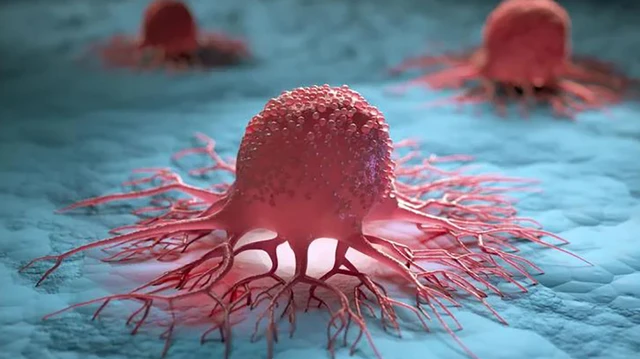 bai-viet/nhung-tac-dung-phu-muon-va-so-lieu-thong-ke-benh-nhi-mac-khoi-u-wilms-o-tre-em-72846.html