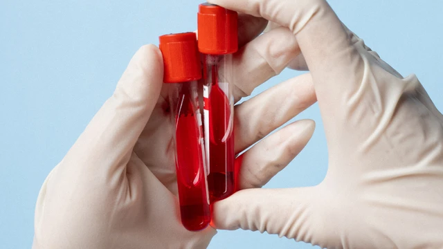 bai-viet/nhung-thong-tin-co-ban-ve-so-do-dong-mau-va-cac-yeu-to-dong-mau.html