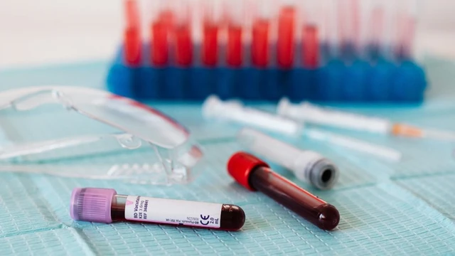 bai-viet/nhung-thong-tin-co-ban-ve-xet-nghiem-lipid-mau-ba-bau-khong-phai-ai-cung-biet.html