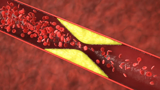 bai-viet/nhung-trieu-chung-benh-mach-vanh-dien-hinh-ma-ban-nen-biet.html