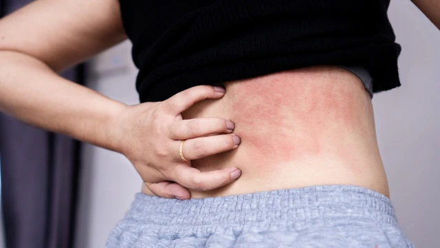 bai-viet/nhung-trieu-chung-san-cho-o-nguoi-ma-ban-can-luu-y.html