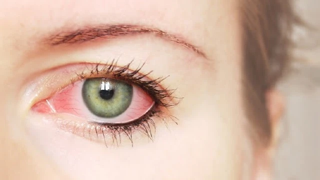 bai-viet/nhung-van-de-ve-sung-khoe-mat-ma-ban-can-biet-52782.html