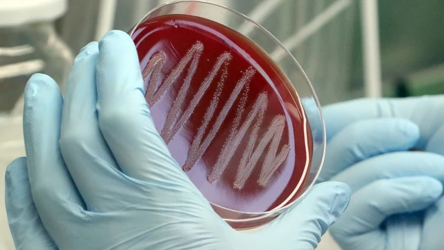 bai-viet/nhuom-gram-la-gi-quy-trinh-thuc-hien-va-cach-phan-tich-ket-qua.html