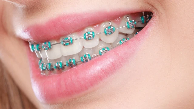 bai-viet/nieng-rang-bao-nhieu-tien-2-ham-co-bao-nhieu-phuong-phap-chinh-nha-pho-bien-hien-nay.html