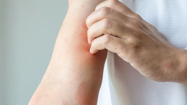 benh/me-day-527.html