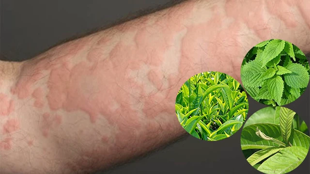 bai-viet/noi-me-day-tam-la-gi-nhanh-khoi-55284.html