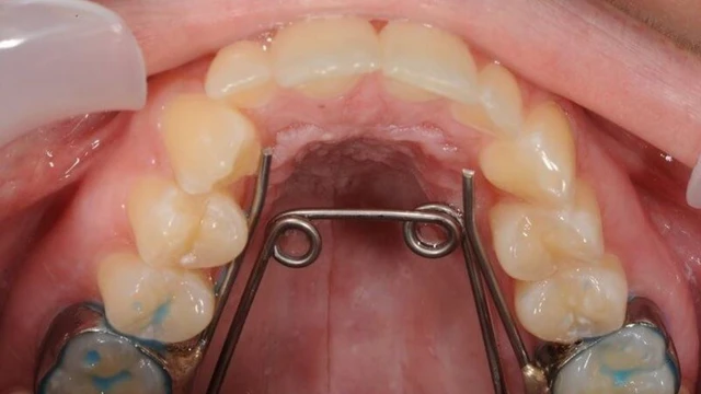 bai-viet/nong-ham-la-gi-khi-nao-can-thuc-hien.html