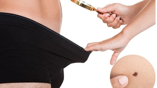 bai-viet/not-ruoi-o-duong-vat-la-dau-hieu-cua-benh-gi-64606.html