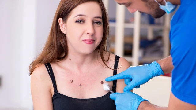 bai-viet/not-ruoi-o-nguc-co-phai-ung-thu-vu-khong.html