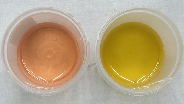 bai-viet/nuoc-tieu-mau-hong-nguyen-nhan-va-cach-phong-ngua-hieu-qua.html