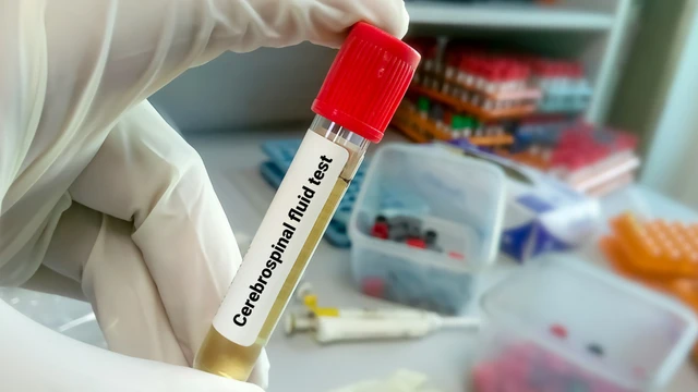 bai-viet/pandy-duong-tinh-la-gi-quy-trinh-thuc-hien-phan-ung-pandy.html