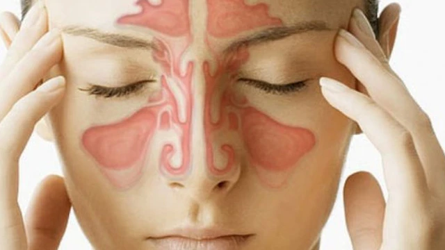 bai-viet/phac-do-dieu-tri-viem-xoang-bo-y-te-moi-nhat.html