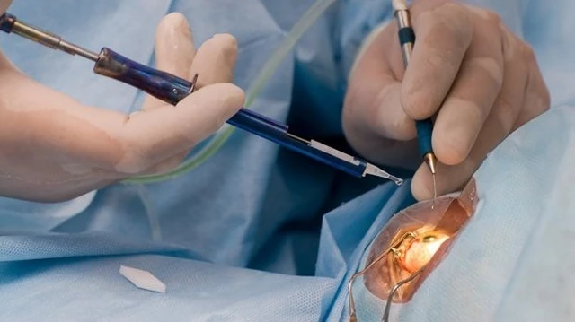 bai-viet/phacoemulsification-la-gi-tim-hieu-ve-phuong-phap-phau-thuat-phaco.html