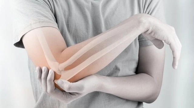 bai-viet/phai-lam-gi-khi-bi-trat-khop-khuyu-tay-58142.html