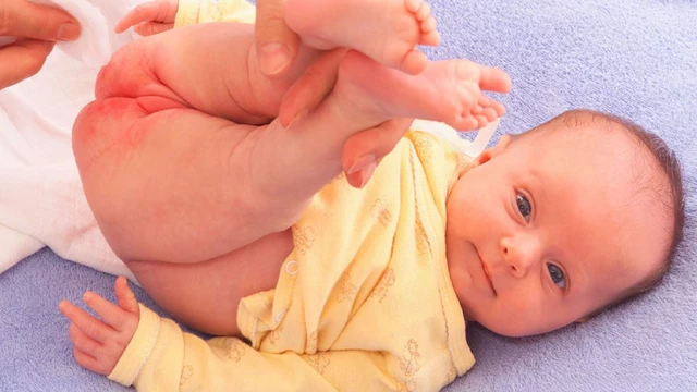 bai-viet/phai-lam-sao-khi-tre-bi-ham-da-do-tieu-chay.html