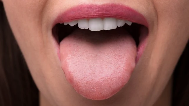 bai-viet/phan-biet-viem-luoi-ban-do-va-ung-thu-luoi-ban-da-biet-chua.html