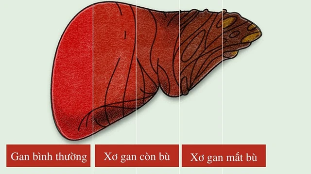 bai-viet/phan-biet-xo-gan-con-bu-xo-gan-mat-bu.html
