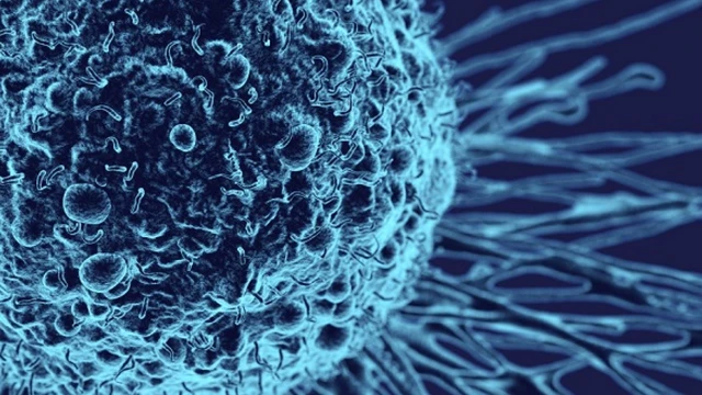 bai-viet/phan-do-mo-hoc-cua-khoi-u-la-gi-54225.html