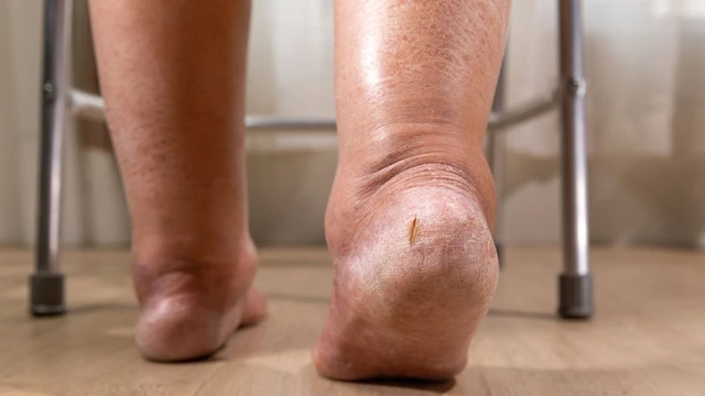 bai-viet/tim-hieu-ve-cac-phan-do-phu-nguyen-nhan-va-cach-dieu-tri.html