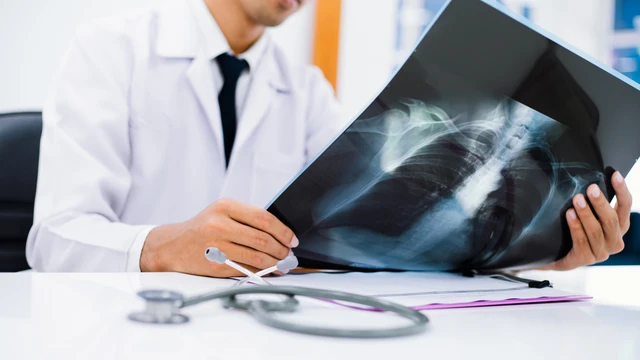 bai-viet/phan-thuy-phoi-tren-phim-x-quang-huong-dan-chi-tiet-va-khoa-hoc.html