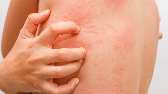 bai-viet/phat-ban-do-stress-dau-hieu-nhan-biet-va-phuong-phap-xu-ly.html