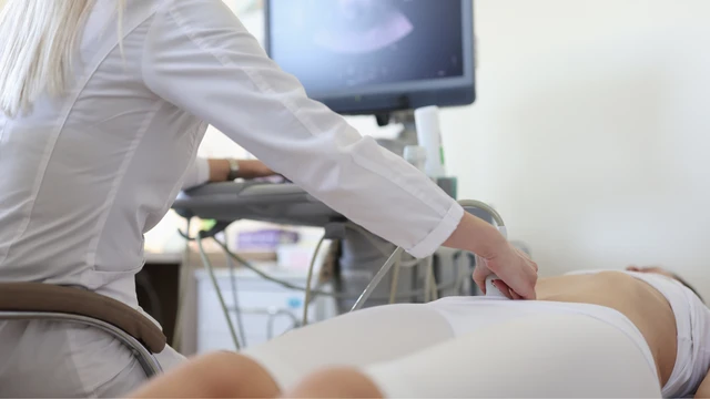 Phát hiện ung thư buồng trứng giai đoạn sớm