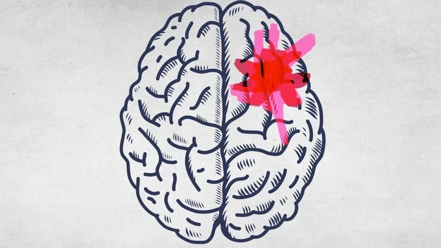 bai-viet/phat-hien-ung-thu-nao-bang-cach-nao-mot-so-thong-tin-can-biet-ve-ung-thu-nao.html