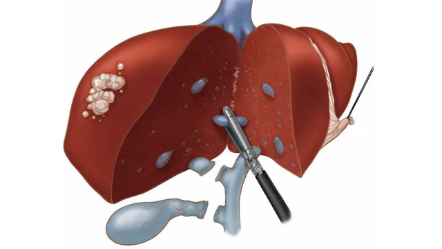 bai-viet/phau-thuat-cat-gan-la-gi-sau-phau-thuat-co-bien-chung-khong.html