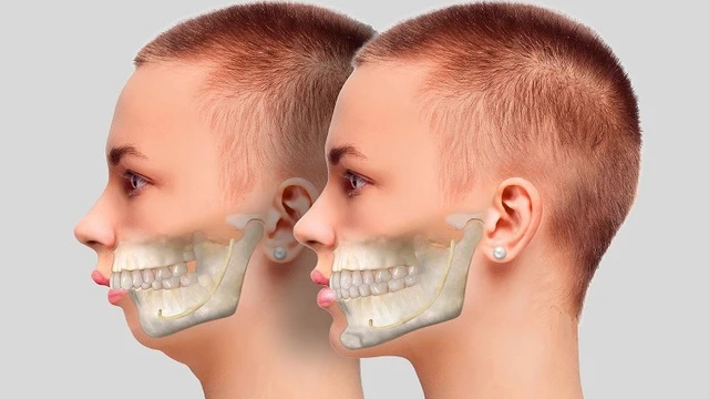 bai-viet/phau-thuat-ham-ho-la-gi-chi-phi-phau-thuat-ham-ho-bao-nhieu.html