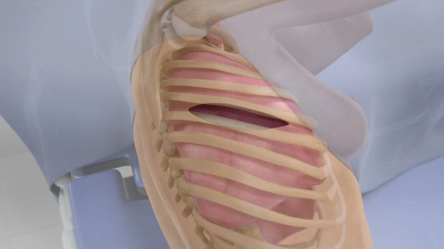 bai-viet/phau-thuat-mo-nguc-tham-do-duoc-su-dung-khi-nao.html