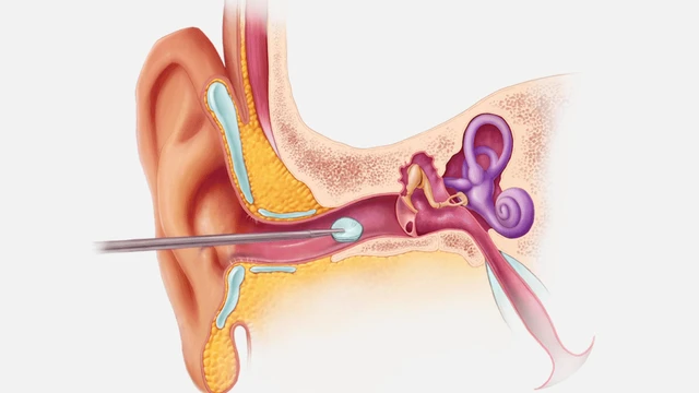 bai-viet/phau-thuat-noi-soi-va-nhi-la-gi-phuong-phap-phau-thuat-nay-co-gay-ra-bien-chung-gi-khong.html