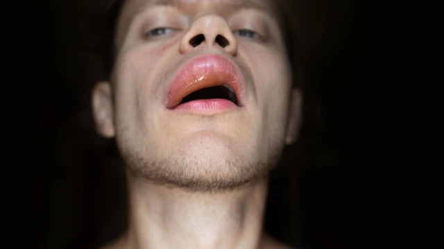 bai-viet/phu-mach-do-thuoc-nguyen-nhan-trieu-chung-va-cach-xu-ly.html