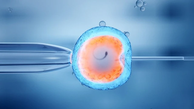 bai-viet/sau-choc-hut-trung-bao-lau-thi-buong-trung-hoi-phuc-bien-phap-cham-soc-sau-thu-thuat.html