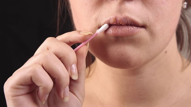 bai-viet/te-moi-trieu-chung-nhe-hay-benh-ly-nghiem-trong.html