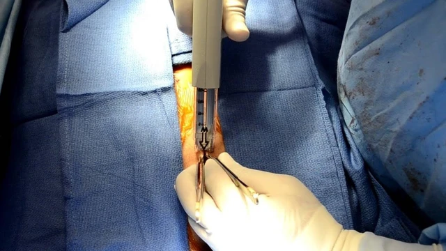 bai-viet/tim-hieu-chi-tiet-ve-phuong-phap-stapler-cung-chuyen-gia.html