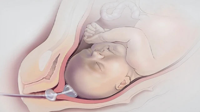 bai-viet/phuong-phap-dat-bong-kich-de-bao-lau-thi-sinh.html