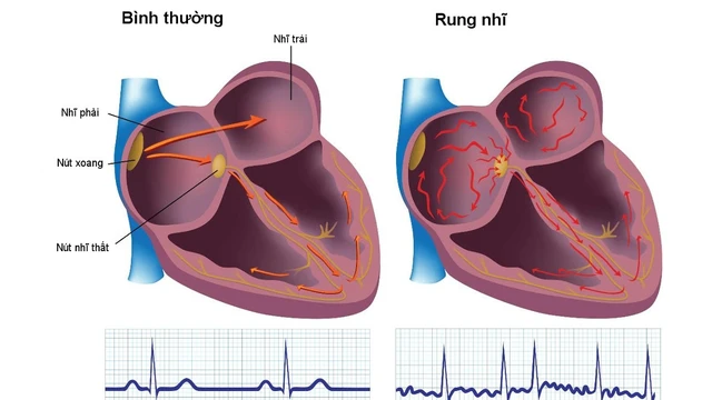 bai-viet/phuong-phap-dieu-tri-thay-the-thuoc-cho-rung-nhi-hien-nay.html