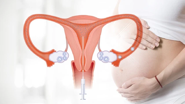 bai-viet/tai-sao-phai-nhin-tieu-truoc-khi-iui-nhung-luu-y-ve-iui-can-biet.html