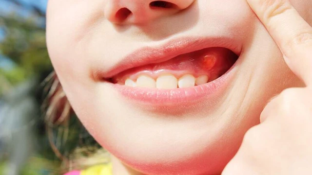 bai-viet/nan-chinh-rang-moc-ngam-bang-phuong-phap-gi.html