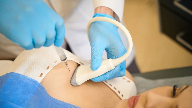 bai-viet/quy-trinh-choc-hut-te-bao-khoi-u-vu-va-mot-so-dieu-cac-chi-em-nen-biet.html